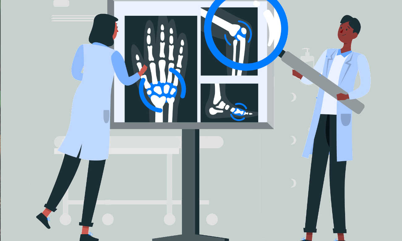 osteoporosi