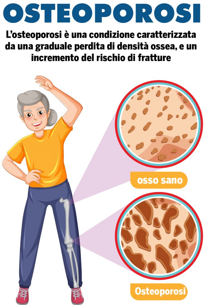 osteoporosi
