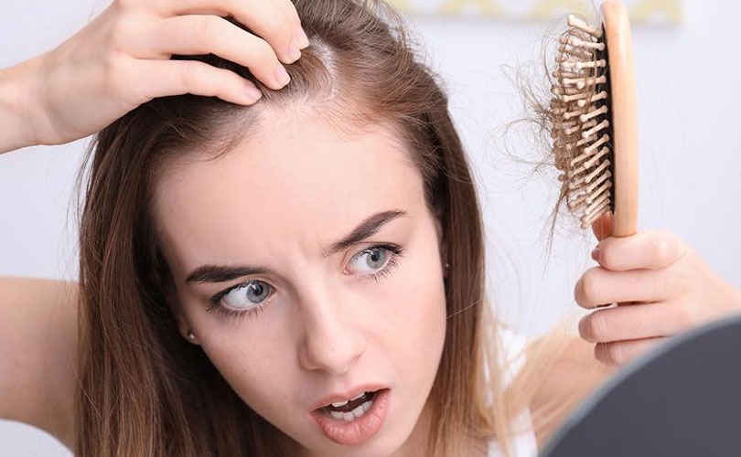 perdita dei capelli1