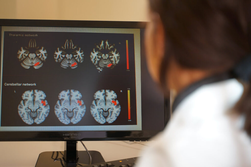 sclerosi multipla cover